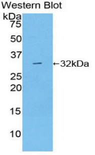 PAE849Hu01.jpg