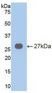 Polyclonal Antibody to Vav 3 Oncogene (VAV3)