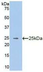 Polyclonal Antibody to Vav 3 Oncogene (VAV3)