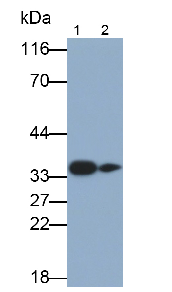 Polyclonal Antibody to G Protein Beta 2 (GNb2)