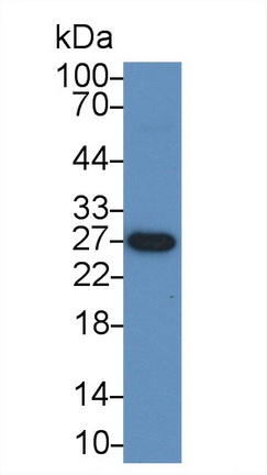 Polyclonal Antibody to Bcl2 Associated Athanogene 2 (BAG2)