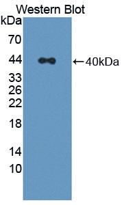 Polyclonal Antibody to Carbonyl Reductase 3 (CBR3)