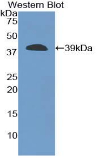 Polyclonal Antibody to Carboxypeptidase B1, Tissue (CPB1)