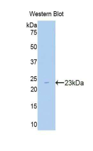 Polyclonal Antibody to Carnitine Palmitoyltransferase 1A, Liver (CPT1A)