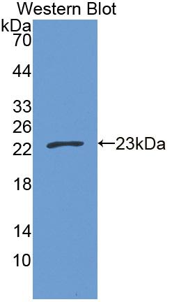 Polyclonal Antibody to Carnitine Palmitoyltransferase 1B, Muscle (CPT1B)