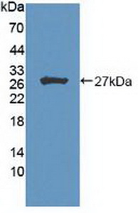 Polyclonal Antibody to Homeodomain Interacting Protein Kinase 2 (HIPK2)