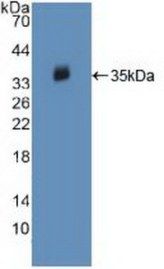 Polyclonal Antibody to Janus Kinase 2 (JAK2)