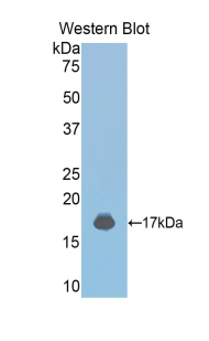 Polyclonal Antibody to Janus Kinase 2 (JAK2)