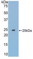 Polyclonal Antibody to Janus Kinase 2 (JAK2)