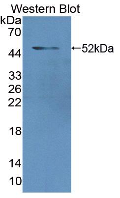 Polyclonal Antibody to Lamin A/C (LMNA)