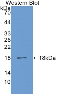 Polyclonal Antibody to Lysyl Oxidase Like Protein 1 (LOXL1)