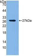 Polyclonal Antibody to Lysyl Oxidase Like Protein 1 (LOXL1)