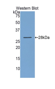 Polyclonal Antibody to Lysyl Oxidase Like Protein 1 (LOXL1)