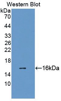 Polyclonal Antibody to Lysyl Oxidase Like Protein 2 (LOXL2)