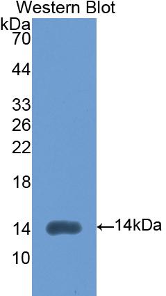 FITC-Linked Polyclonal Antibody to Lysyl Oxidase Like Protein 2 (LOXL2)