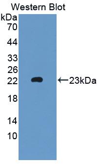 Polyclonal Antibody to Myotubularin Related Protein 9 (MTMR9)