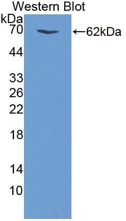 Polyclonal Antibody to Phosphodiesterase 3A, cGMP Inhibited (PDE3A)