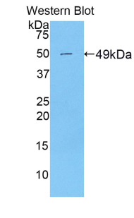 Polyclonal Antibody to Peroxiredoxin 3 (PRDX3)