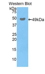 Polyclonal Antibody to Peroxiredoxin 3 (PRDX3)