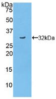 Polyclonal Antibody to Tumor Necrosis Factor Alpha Induced Protein 3 Interacting Protein 2 (TNIP2)