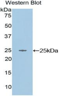 Polyclonal Antibody to Tumor Necrosis Factor Alpha Induced Protein 3 Interacting Protein 2 (TNIP2)