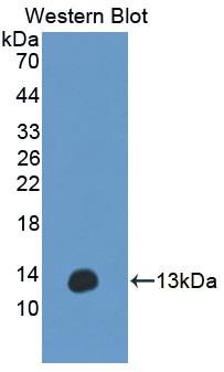 Polyclonal Antibody to Anoctamin 6 (ANO6)