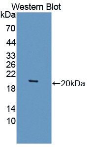 Polyclonal Antibody to Septin 6 (SEPT6)