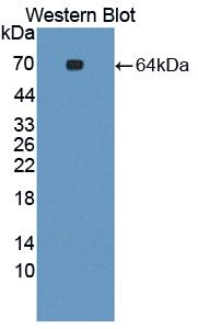 Polyclonal Antibody to Syncoilin (SYNC)