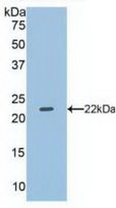 Polyclonal Antibody to Dual Specificity Phosphatase 3 (DUSP3)