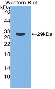 Polyclonal Antibody to TNF Receptor Associated Factor 1 (TRAF1)