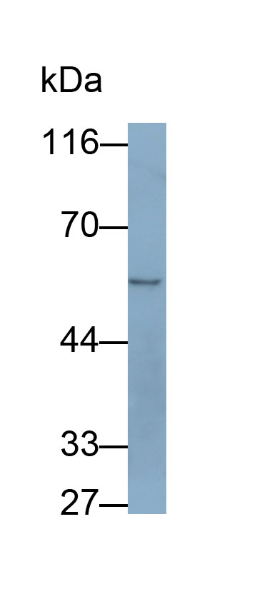 Polyclonal Antibody to Tyrosyl tRNA Synthetase 2, Mitochondrial (YARS2)