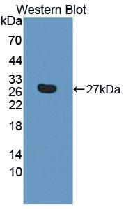 Polyclonal Antibody to Aspartate Beta Hydroxylase (ASPH)