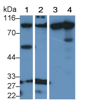 Polyclonal Antibody to Ubiquitin Like Modifier Activating Enzyme 2 (UBA2)