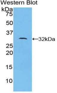 PAG175Hu01.jpg