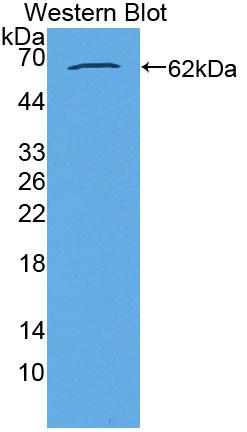 Polyclonal Antibody to Acylglycerol Kinase (AGK)