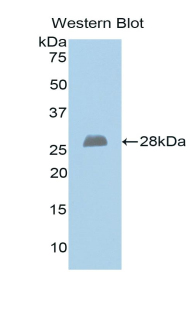 Polyclonal Antibody to Exostoses 1 (EXT1)