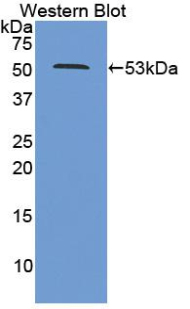 Polyclonal Antibody to Proteasome 26S Subunit, ATPase 2 (PSMC2)