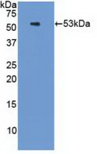 Polyclonal Antibody to Proteasome 26S Subunit, ATPase 3 (PSMC3)