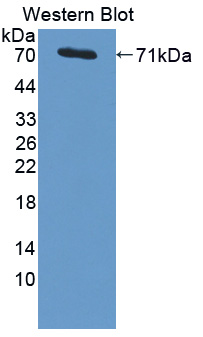 Polyclonal Antibody to Proteasome 26S Subunit, Non ATPase 4 (PSMD4)