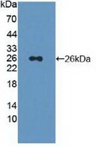 Polyclonal Antibody to Proteasome 26S Subunit, Non ATPase 5 (PSMD5)