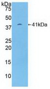 Polyclonal Antibody to Proteasome 26S Subunit, Non ATPase 7 (PSMD7)