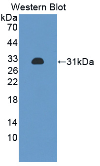 Polyclonal Antibody to Protein Kinase, AMP Activated Beta 2 (PRKAb2)