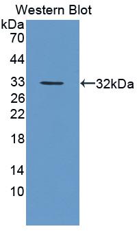 Polyclonal Antibody to Polyamine Modulated Factor 1 Binding Protein 1 (PMFBP1)