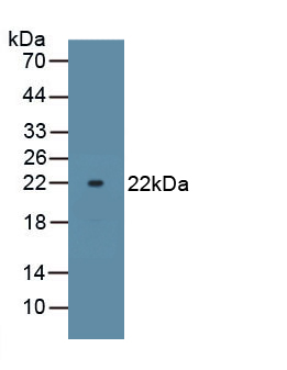 Polyclonal Antibody to ATPase, Na+/K+ Transporting Alpha 1 Polypeptide (ATP1a1)