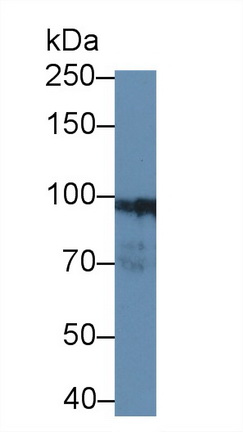 Polyclonal Antibody to Desmocollin 1 (DSC1)