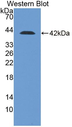 Polyclonal Antibody to Desmocollin 2 (DSC2)