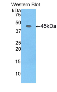 PAG458Hu01.jpg