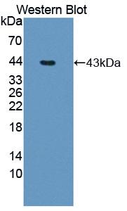 Polyclonal Antibody to 5-Methyltetrahydrofolate Homocysteine Methyltransferase (MTR)