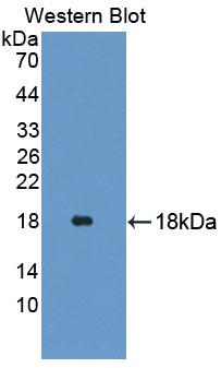 Polyclonal Antibody to Glycine Dehydrogenase (GLDC)