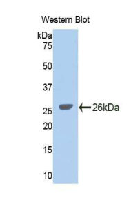 Polyclonal Antibody to Glycine Dehydrogenase (GLDC)